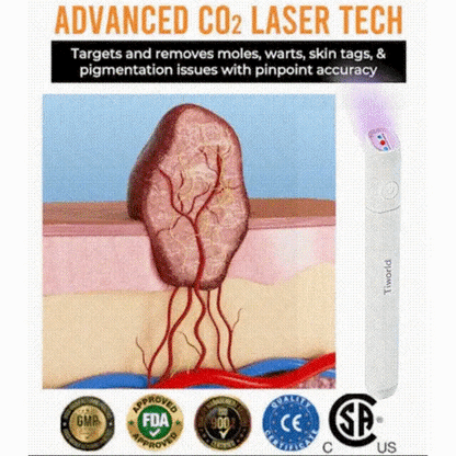 All-in-One Laser Eraser Pen